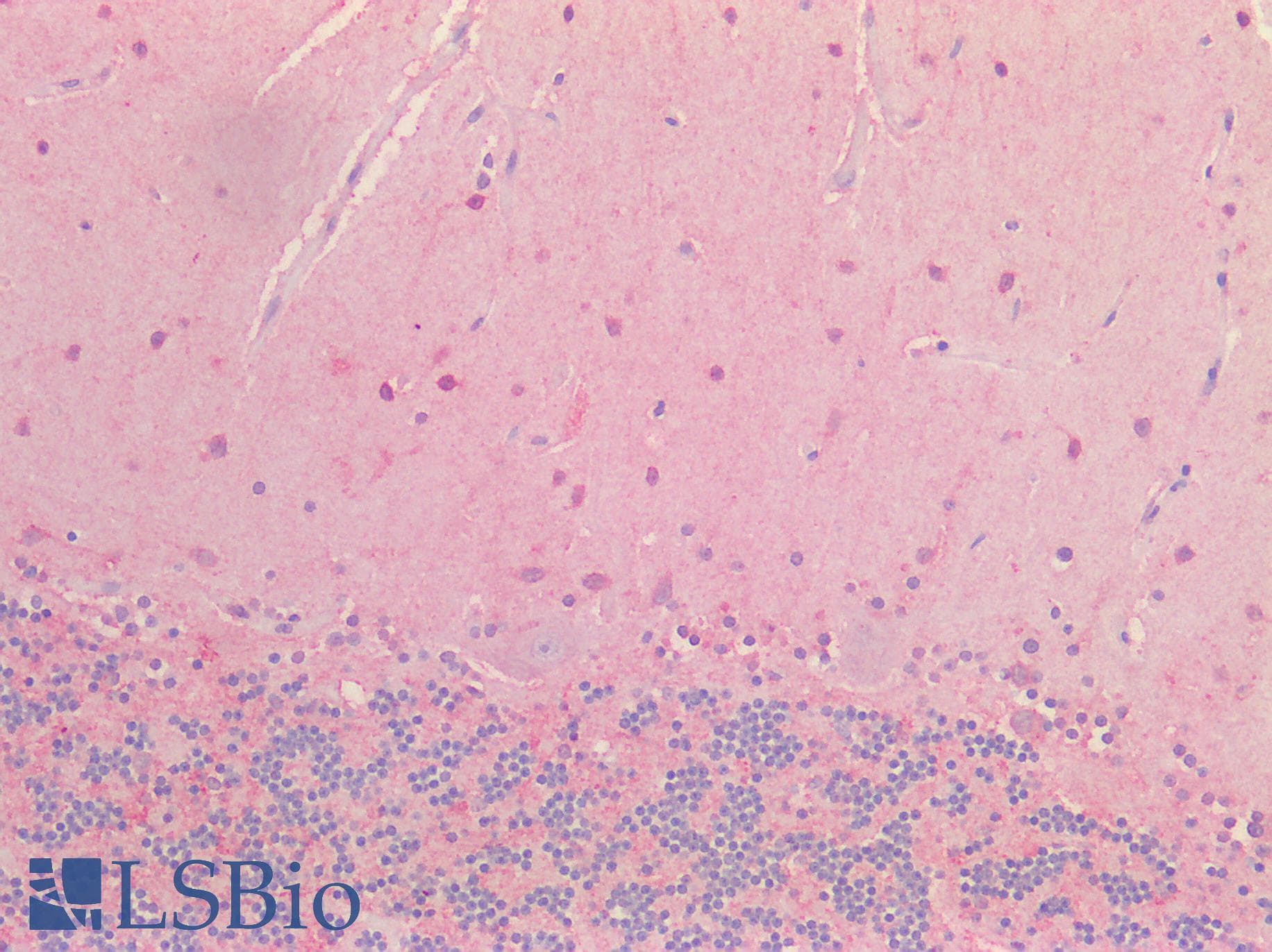 PathPlus™ NOS1 / nNOS Antibody (aa1457-1468)