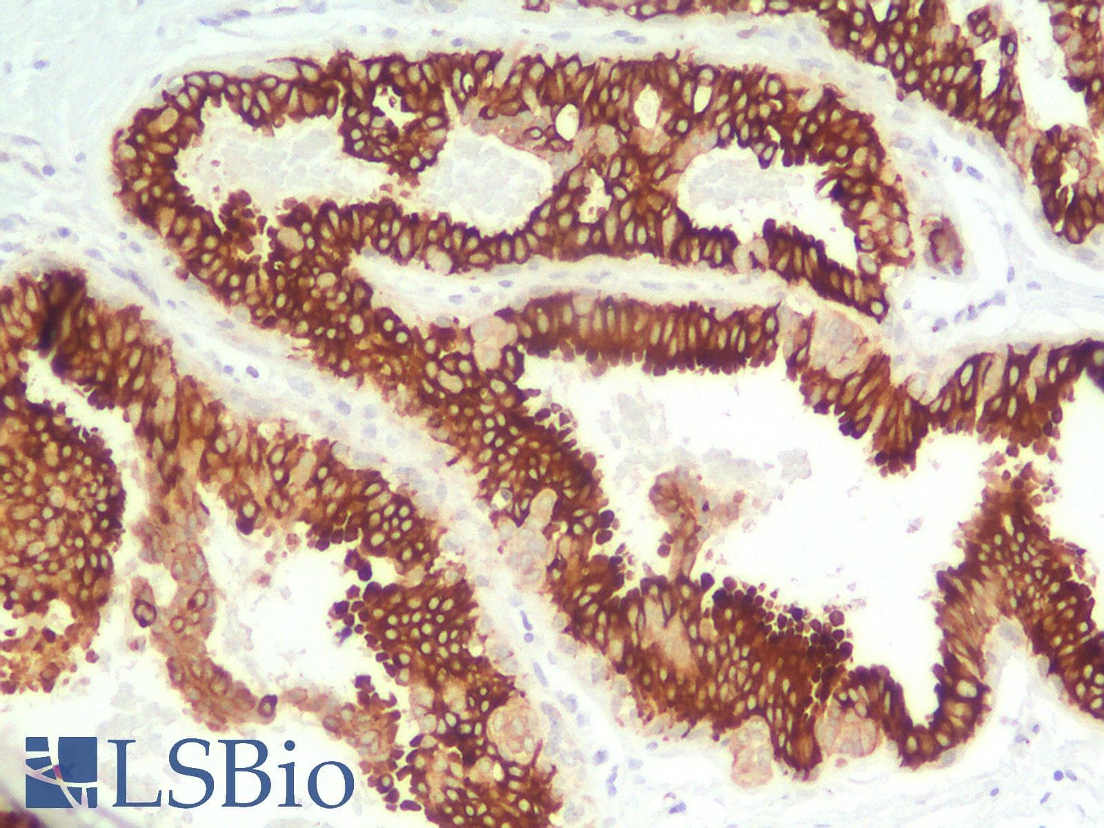 PathPlus™ Monoclonal Mouse anti-Human KRT18 / CK18 / Cytokeratin 18 Antibody (Concentrated, IHC)