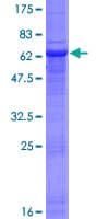 Human NSDHL Protein (Recombinant GST)