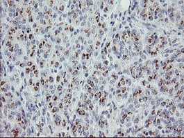 PHKG2 Antibody (aa1-216, clone OTI1F9)