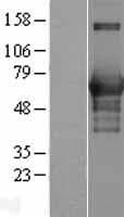 CAMKK1 Protein (Over-Expression Lysate Myc-DDK (Flag))