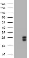 Monoclonal Mouse anti-Human WFDC2 / HE4 Antibody (clone OTI1E12, aa31-124, IHC, WB)