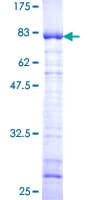Human NAP1L1 Protein (Recombinant GST)