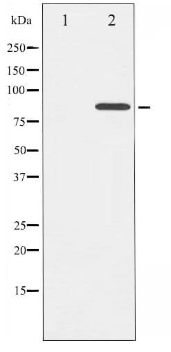 CTTN / Cortactin Antibody (phospho-Tyr421)