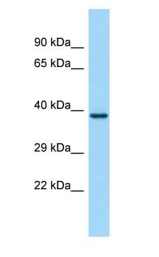 FP / PTGFR Antibody (aa199-248)