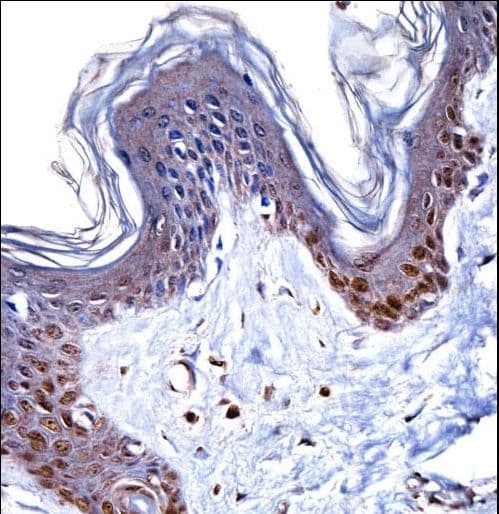 Polyclonal Rabbit anti-Human HMGN1 / HMG14 Antibody (aa1-30, IHC, WB)