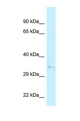 CAPZA2 / CAPZ Alpha 2 Antibody (N-Terminus)