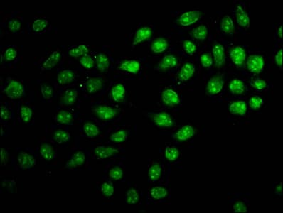 Polyclonal Rabbit anti-Human ZNF224 Antibody (IHC, IF)