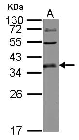 Polyclonal Rabbit anti-Human ULBP1 Antibody (WB)