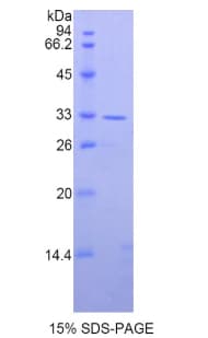 Human AXIN2 / Axin 2 Protein (Recombinant His)