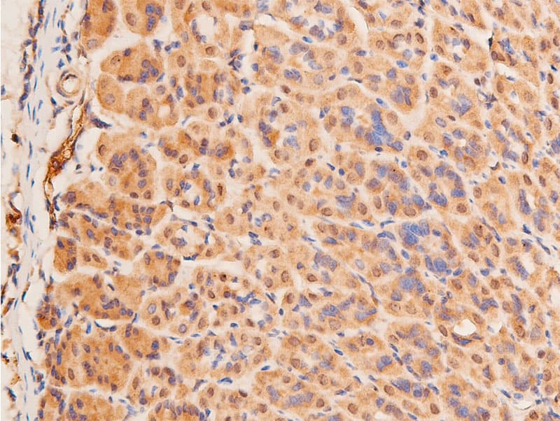 TP53 / p53 Antibody (phospho-Ser15)