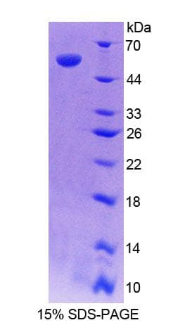 Human RARRES1 Protein (Recombinant His-GST)