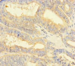 NIPSNAP3B Antibody