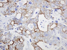 Monoclonal Mouse anti-Human ABCB1 / MDR1 / P Glycoprotein Antibody (clone OTI2C7, IHC, WB)
