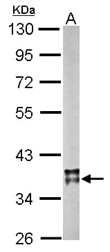 IHC-plus™ Polyclonal Rabbit anti-Human MDH / MDH2 Antibody (aa40-319, IHC, WB)