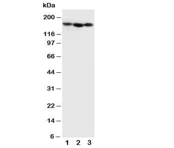 COL4A1 / Collagen IV Alpha1 Antibody (aa1654-1669)
