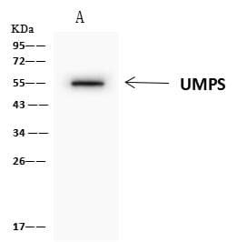 Polyclonal Rabbit anti-Human UMPS / OPRT Antibody (IHC, WB)