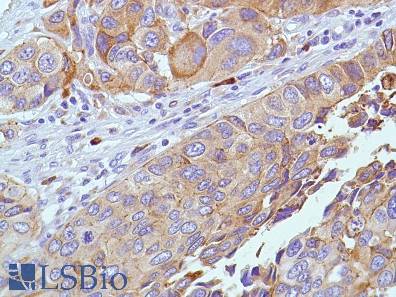 PTGS2 / COX2 / COX-2 Antibody (C-Terminus, clone SP21)