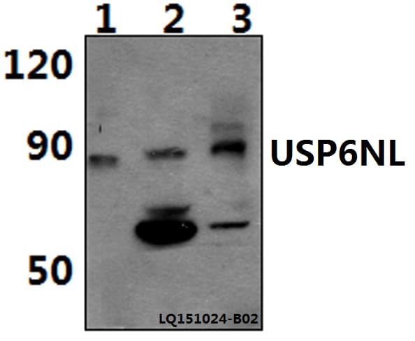 Polyclonal Rabbit anti-Human USP6NL Antibody (WB)