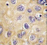 Polyclonal Rabbit anti-Human CLDN1 / Claudin 1 Antibody (aa40-82, IHC, WB)