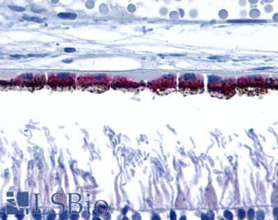 PathPlus™ Polyclonal Rabbit anti-Human Peropsin / RRH Antibody (Cytoplasmic Domain, IHC)