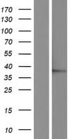 JMJD7 Protein (Over-Expression Lysate Myc-DDK (Flag))