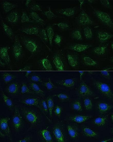 RAPGEF1 Antibody