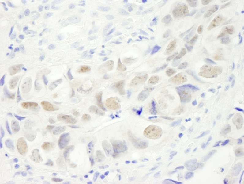 Polyclonal Rabbit anti-Human Anillin Antibody (aa1074-1124, IHC)