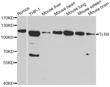 Polyclonal Rabbit anti-Human TLR8 Antibody (IHC, IF, WB)