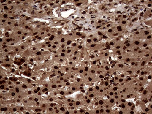 Monoclonal Mouse anti-Human TALDO1 / Transaldolase 1 Antibody (clone OTI1A5, IHC, WB)