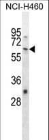 NELFA / WHSC2 Antibody (aa251-279)