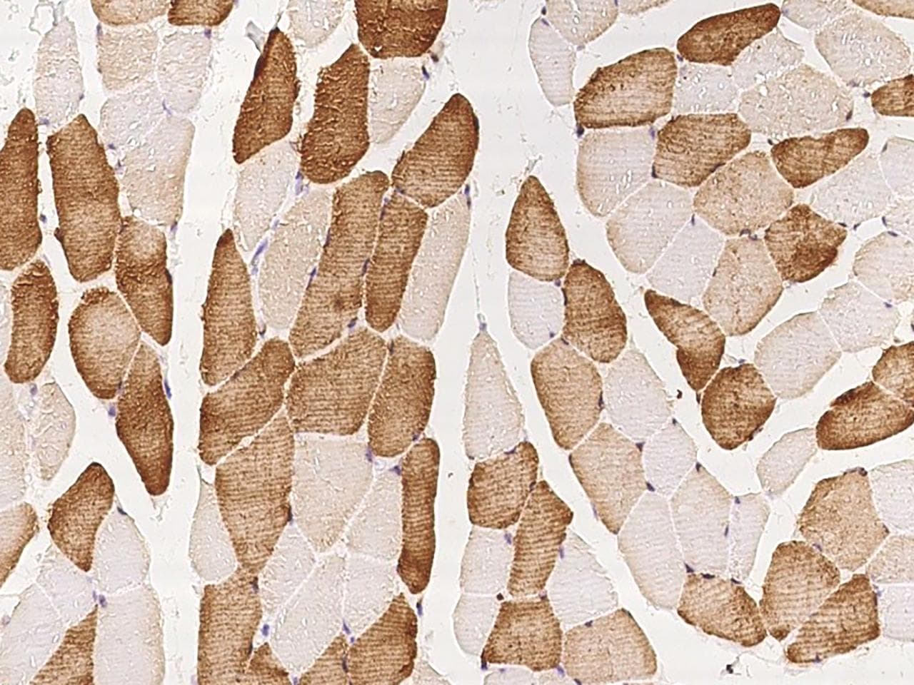Polyclonal Rabbit anti-Human PLN / Phospholamban Antibody (IHC)