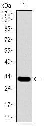 SLC27A5 / BACS Antibody (Amino Acid: 508-570, clone 4B11C10)