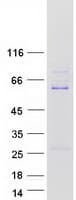 Human ZSCAN21 / Zipro1 Protein (Recombinant Myc-DDK (Flag))