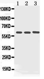 KRT5 / CK5 / Cytokeratin 5 Antibody