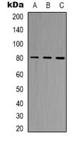 Polyclonal Rabbit anti-Human BAG3 / BAG-3 Antibody (Internal, IHC, WB)