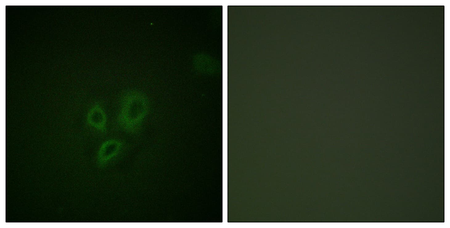 TNNI3 / Cardiac Troponin I Antibody (aa5-54)