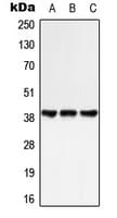 GPR25 Antibody (Internal)