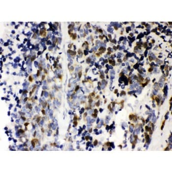 CCNA2 / Cyclin A2 Antibody (aa10-168)