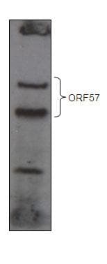 Polyclonal Rabbit anti-Human Herpesvirus 8 HHV-8 ORF57 Antibody (aa33-60, WB)