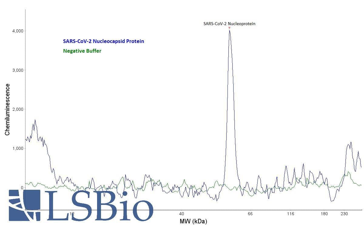 SARS-CoV-2 Nucleoprotein Antibody