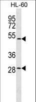 ZNF324 / ZF5128 Antibody (aa490-518)