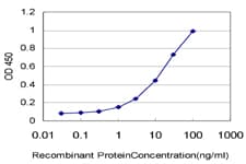 IHC-plus™ CTNS / Cystinosin Antibody (clone 5G6)