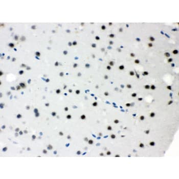 SNRPN Antibody (aa11-39)