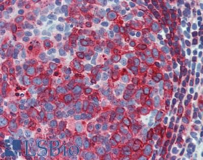 IHC-plus™ HLA-DP/DR Antibody (clone MEM-136)