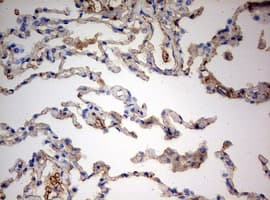 PARN Antibody (aa1-266, clone OTI4D12)
