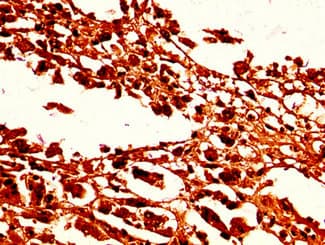HIST1H1C Antibody