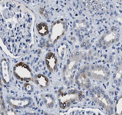 GRIK1 / GLUR5 Antibody