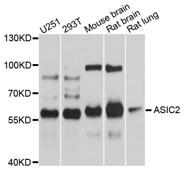 ACCN1 / ASIC2 Antibody