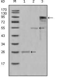 PathPlus™ Monoclonal Mouse anti-Human MPO / Myeloperoxidase Antibody (clone 9B12G7, IHC, WB)